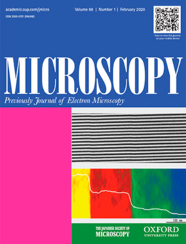 Editor's Choice Microscopy Vol. 69, No.1