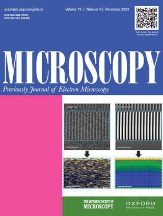 Microscopy vol.72
